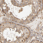 Immunohistochemical staining of human testis shows strong membranous and cytoplasmic positivity in cells in seminiferous ducts.