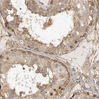Immunohistochemical staining of human testis shows strong membranous and cytoplasmic positivity in cells in seminiferous ducts.