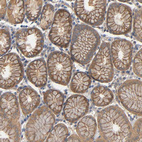 Immunohistochemical staining of human stomach shows moderate membranous and cytoplasmic positivity in glandular cells.