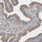 Immunohistochemical staining of human fallopian tube shows weak to moderate membranous and cytoplasmic positivity in glandular cells.