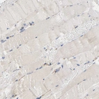 Immunohistochemical staining of human skeletal muscle shows no positivity in myocytes as expected.