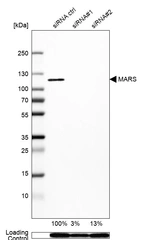 Western blot analysis in Rh30 cells transfected with control siRNA, target specific siRNA probe #1 and #2, using Anti-MARS antibody. Remaining relative intensity is presented. Loading control: Anti-GAPDH.