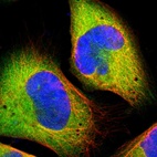 Immunofluorescent staining of human cell line U-2 OS shows localization to cytosol.
