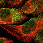 Immunofluorescent staining of human cell line U-2 OS shows localization to nucleoplasm & vesicles.