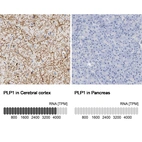Anti-PLP1 Antibody