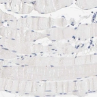 Immunohistochemical staining of human skeletal muscle shows no positivity in myocytes as expected.