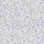 Immunohistochemical staining of human liver shows no positivity in hepatocytes as expected.
