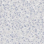 Immunohistochemical staining of human liver shows no positivity in hepatocytes as expected.