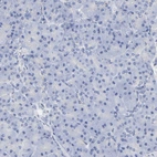 Immunohistochemical staining of human pancreas shows no positivity in exocrine glandular cells as expected.