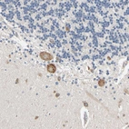 Anti-RARS Antibody