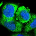 Immunofluorescent staining of human cell line A-431 shows localization to cytosol.