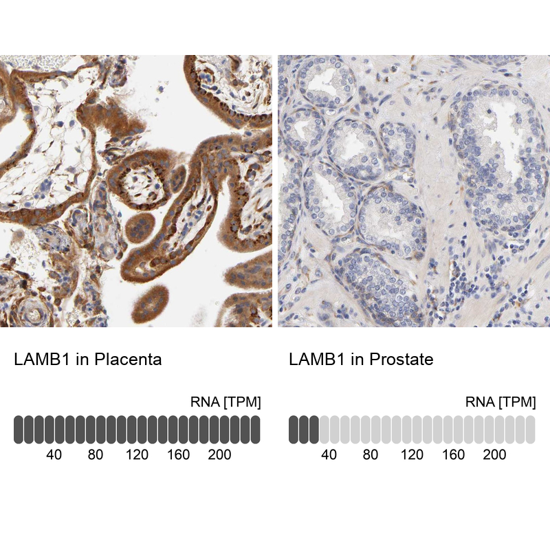 Anti-LAMB1 Antibody