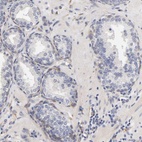 Anti-LAMB1 Antibody