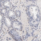 Immunohistochemical staining of human prostate shows low expression as expected.