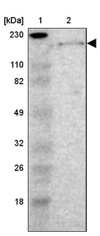 Lane 1: Marker [kDa] 230, 110, 82, 49, 32, 26, 18_br/_Lane 2: Human cell line RT-4