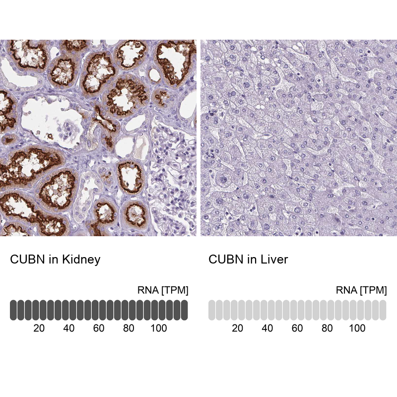 Anti-CUBN Antibody