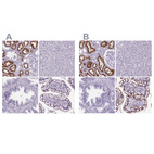 Immunohistochemical staining of human kidney, liver, prostate and small intestine using Anti-CUBN antibody HPA004133 (A) shows similar protein distribution across tissues to independent antibody HPA043854 (B).