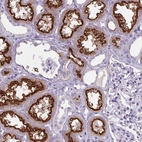 Immunohistochemical staining of human kidney shows strong positivity in apical membrane in cells in proximal tubules.