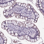 Immunohistochemical staining of human small intestine shows weak cytoplasmic positivity in glandular cells.