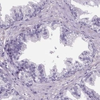 Immunohistochemical staining of human prostate shows no positivity in glandular cells as expected.