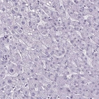 Immunohistochemical staining of human liver shows no positivity in hepatocytes as expected.