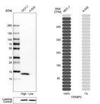 Western blot analysis in human cell lines MCF-7 and A-549 using Anti-CRABP2 antibody. Corresponding CRABP2 RNA-seq data are presented for the same cell lines. Loading control: Anti-HSP90B1.