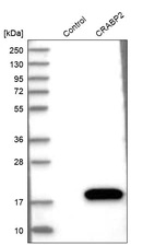Western blot analysis in control (vector only transfected HEK293T lysate) and CRABP2 over-expression lysate (Co-expressed with a C-terminal myc-DDK tag (~3.1 kDa) in mammalian HEK293T cells, LY419677).