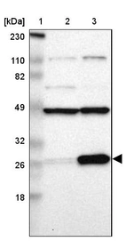 Lane 1: Marker [kDa] 230, 110, 82, 49, 32, 26, 18_br/_Lane 2: Human cell line RT-4_br/_Lane 3: Human cell line U-251MG sp