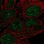 Anti-ZNF429 Antibody