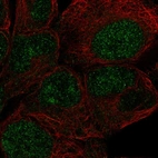 Anti-ZNF429 Antibody