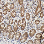 Anti-ACSS2 Antibody