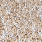 Immunohistochemical staining of human stomach shows weak cytoplasmic positivity in glandular cells.