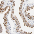 Immunohistochemical staining of human Fallopian tube shows moderate cytoplasmic positivity in glandular cells.