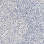 Immunohistochemical staining of human tonsil shows no positivity in lymphocytes as expected.