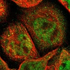 Immunofluorescent staining of human cell line A-431 shows localization to nucleoplasm, cytosol & vesicles.