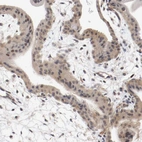 Immunohistochemical staining of human placenta shows weak cytoplasmic positivity in trophoblastic cells.