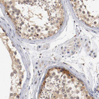 Immunohistochemical staining of human testis shows weak to moderate cytoplasmic positivity in cells in seminiferous ducts.