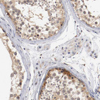 Anti-RBM23 Antibody