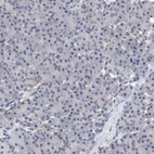 Immunohistochemical staining of human pancreas shows no positivity in exocrine glandular cells as expected.