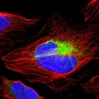 Immunofluorescent staining of human cell line U-2 OS shows localization to intermediate filaments.