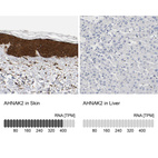 Anti-AHNAK2 Antibody