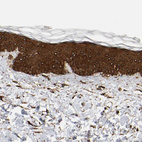 Immunohistochemical staining of human skin shows strong cytoplasmic positivity in squamous epithelial cells.