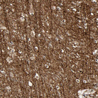 Anti-AHNAK2 Antibody