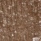 Immunohistochemical staining of human cerebral cortex shows strong positivity in neuropil.