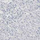 Immunohistochemical staining of human liver shows no cytoplasmic positivity in hepatocytes as expected.