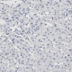 Immunohistochemical staining of human liver shows no cytoplasmic positivity in hepatocytes as expected.