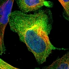 Immunofluorescent staining of human cell line U-2 OS shows localization to plasma membrane & cytosol.
