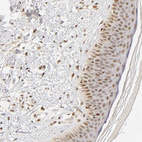 Immunohistochemical staining of human skin shows moderate nuclear positivity in squamous epithelial cells with additional weak cytoplasmic positivity.