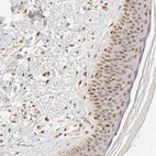 Immunohistochemical staining of human skin shows moderate nuclear positivity in squamous epithelial cells with additional weak cytoplasmic positivity.