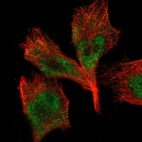 Immunofluorescent staining of human cell line U-251 MG shows localization to nucleoplasm.